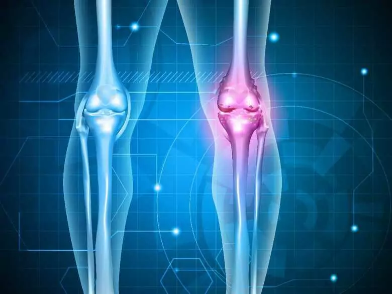 Sklejanie złamanych kości - czy to możliwe?