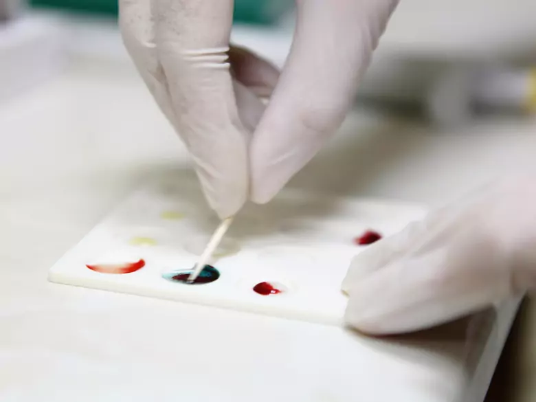 Malaria mózgowa - najgroźniejsza z postaci malarii