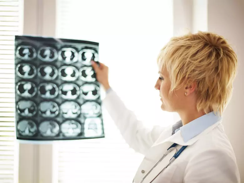 Glejaki mózgu - najważniejsze informacje dla pacjenta