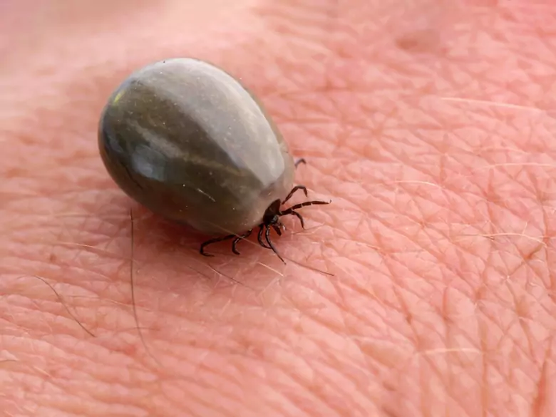 Kleszczowe zapalenie mózgu – groźne i nieprzewidywalne