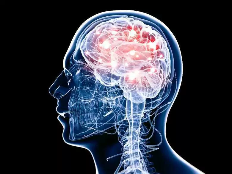 Mielinoliza środkowa mostu: choroba, której przyczyną bywa zbyt intensywne leczenie