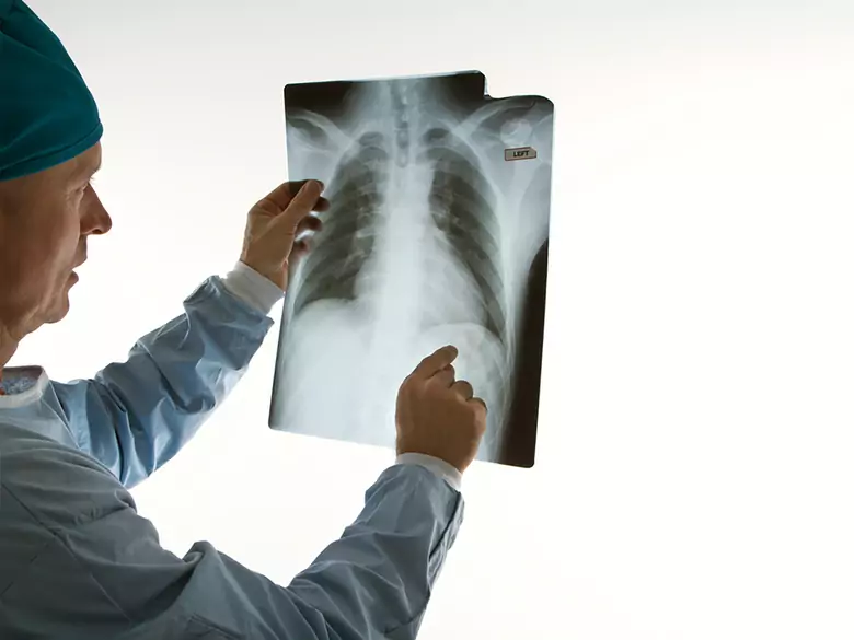 Bóle pleców – co powinieneś wiedzieć